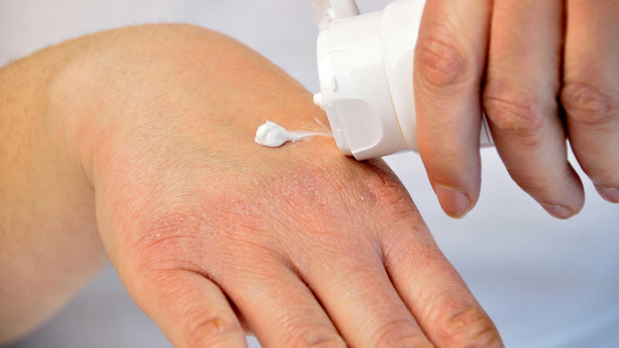 creme til tørre hænder creme til tørre hænder